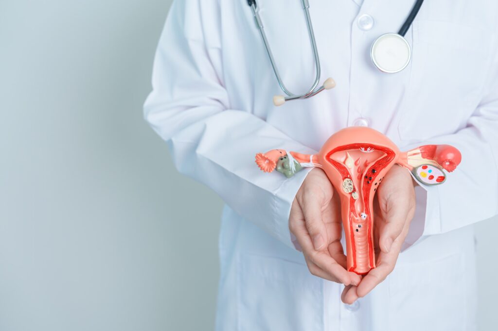 Doctor holding Uterus and Ovaries model. Ovarian and Cervical
