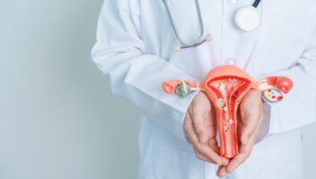 Doctor holding Uterus and Ovaries model. Ovarian and Cervical