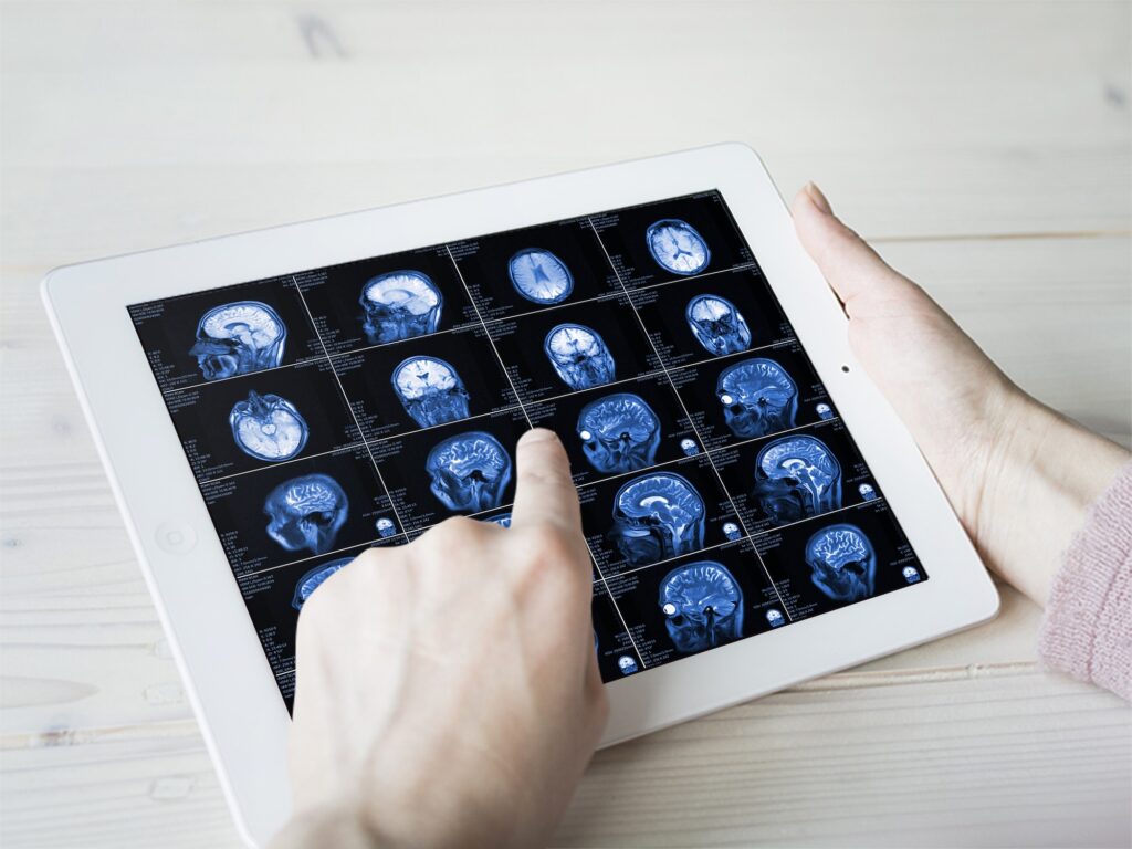 Hands hold MRI scan of head, neck and brain of patient, holding in hands.