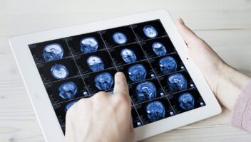 Hands hold MRI scan of head, neck and brain of patient, holding in hands.